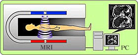 MRIのしくみ